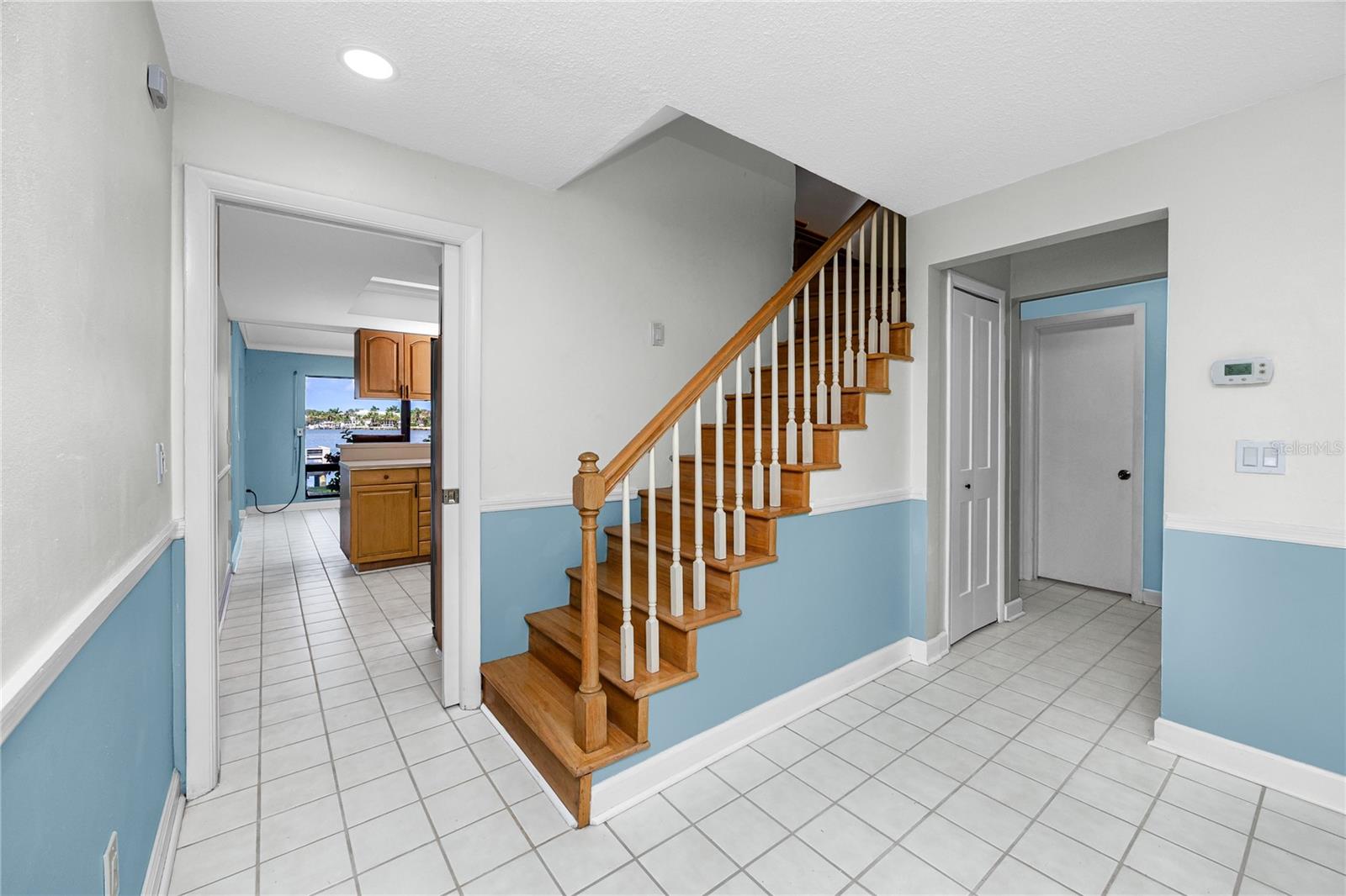 517 20TH AVE — photo 28